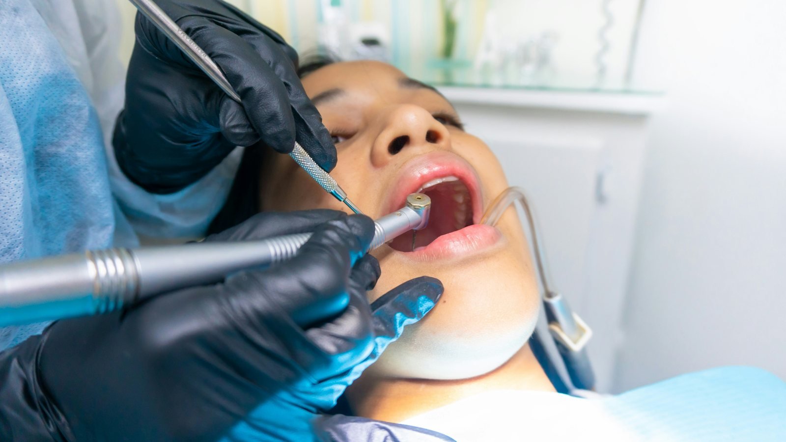 Root Canal Treatment at Dental Universe, Kestopur