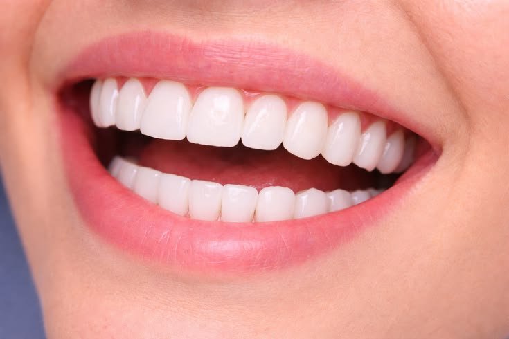 Smile Designing at Dental Universe, Kestopur