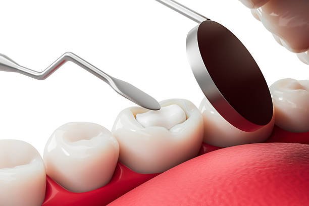 Teeth Whitening in Baguiati: 7 Powerful Tips for a Brighter Smile